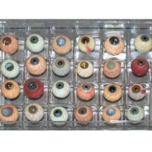 Diseased glass eyes made of blown glass for teaching