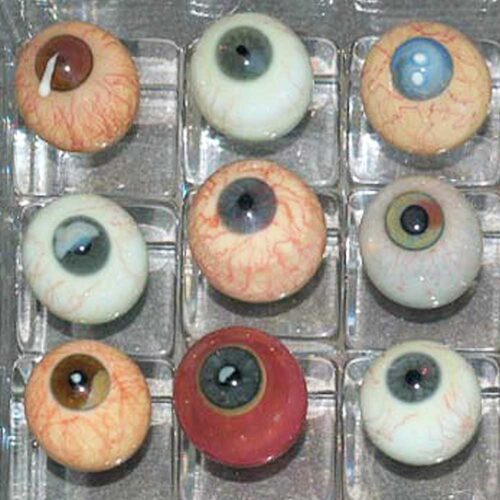 Diseased glass eyes made of blown glass for teaching 3