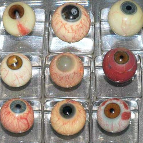 Diseased glass eyes made of blown glass for teaching 5