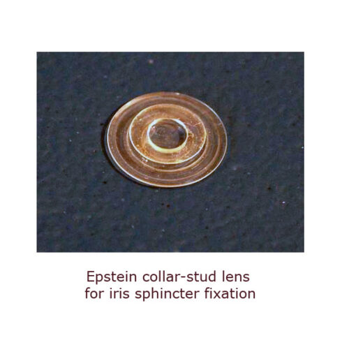 Intraocular lens assortment - Image 23