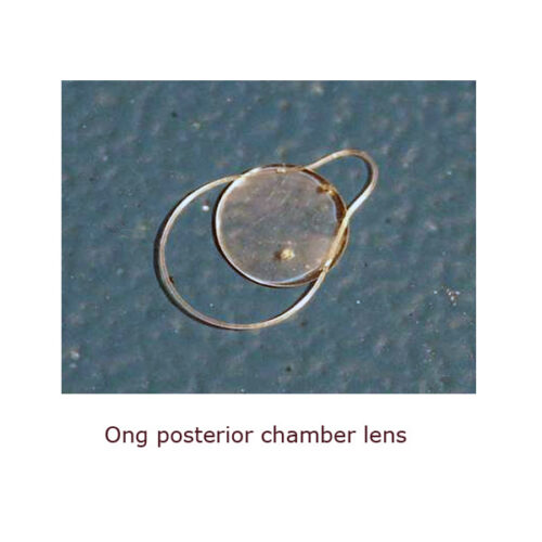 Intraocular lens assortment - Image 34